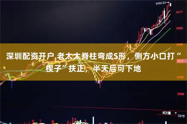 深圳配资开户 老太太脊柱弯成S形，侧方小口打“楔子”扶正，半天后可下地